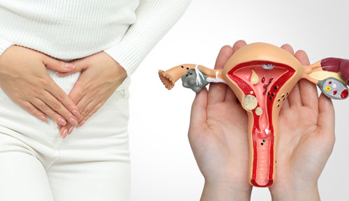 PCOS Treatment