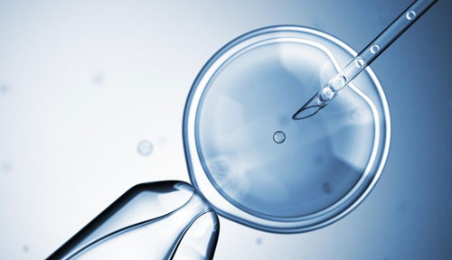 IVF Treatment