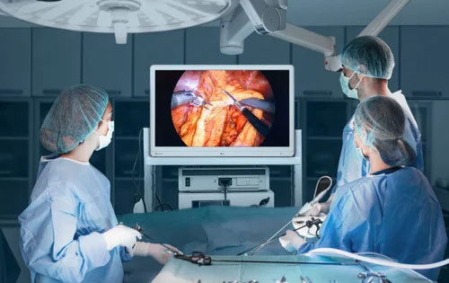 3D Laparoscopy