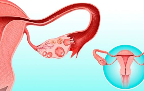 Ovulation Induction
