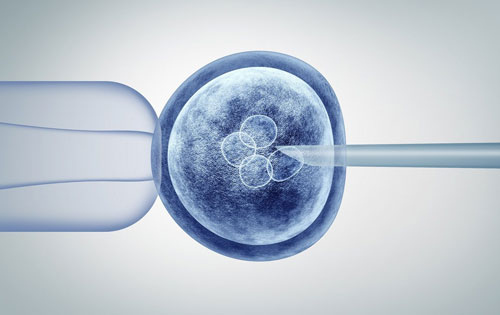 IVF Treatment