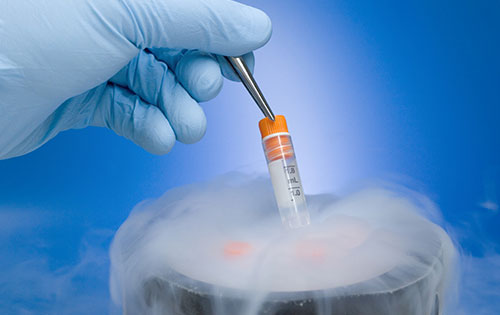 Embryo Freezing