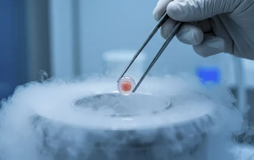 Egg Freezing