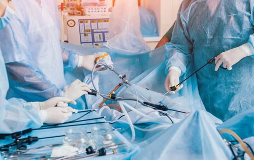 Advanced Laparoscopy